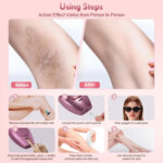 IPL LASER HAIR REMOVAL - Image 4