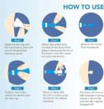 Auto Skin Tag Remover Kit - Image 2