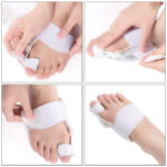 Toe straightener - Image 2