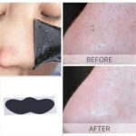 Nose Strips - Image 2