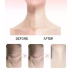 THERAPY NECK MASSAGER - Image 3