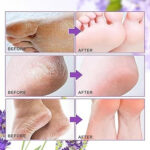 Foot Peel Mask - Image 3