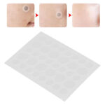 SKIN TAG ACNE PATCH DOTS (36 DOTS) - Image 5