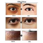 Alovera Eye Mask - Image 6