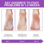 Foot Peel Mask - Image 4