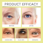 RETINAL SHOT TIGHTENING BOOSTER - Image 5