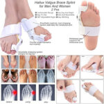 Toe straightener - Image 4