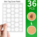 SKIN TAG ACNE PATCH DOTS (36 DOTS) - Image 7