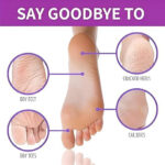 Foot Peel Mask - Image 5