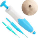 Auto Skin Tag Remover Kit